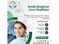 smile-confidently-with-archak-dental-your-best-dental-clinic-in-bangalore-small-0